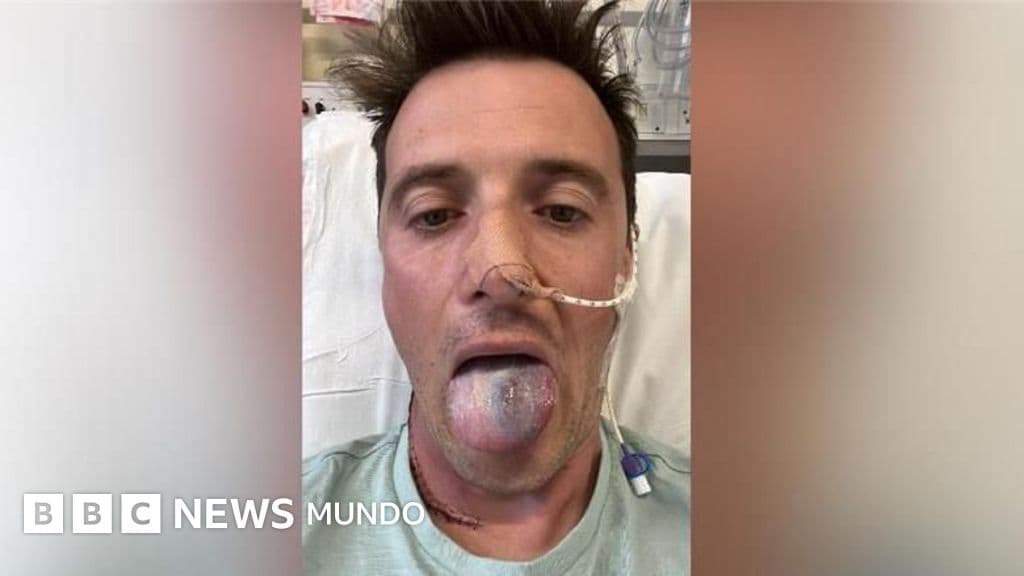 El virus que casi le quita la lengua a un padre: la vacuna y la detección no pueden esperar
