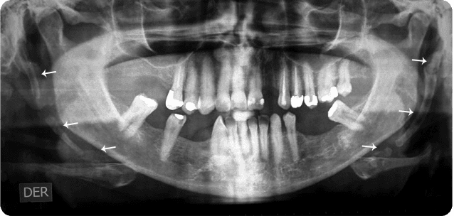 El episodio del Unabomber: cuando las palabras del terror entregaron al autor