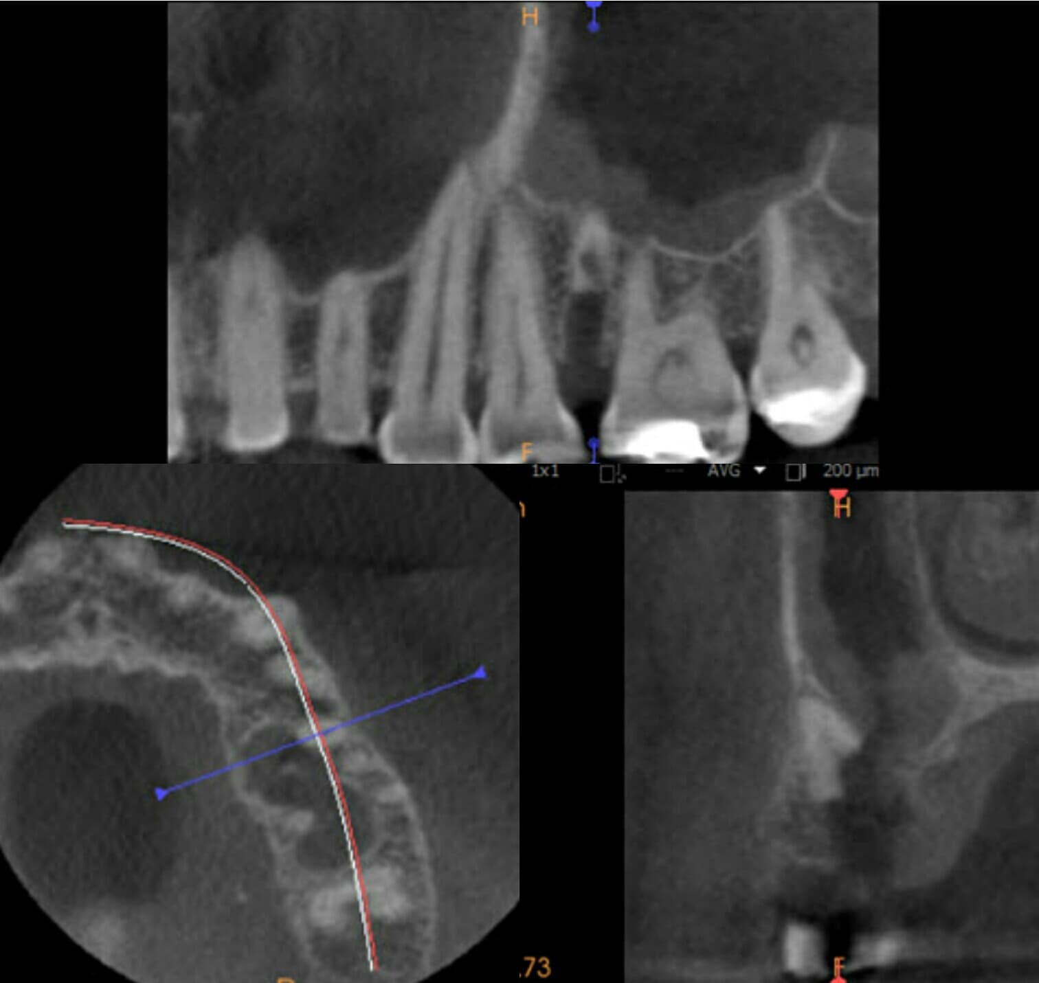 Irán confirma la muerte de su jefe de inteligencia y apunta a aliados: la sombra de Trump en la acusación