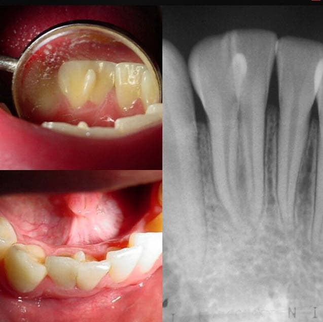 La Luna reclama su lugar: Christina Koch, la primera mujer que viaja alrededor de nuestro satélite